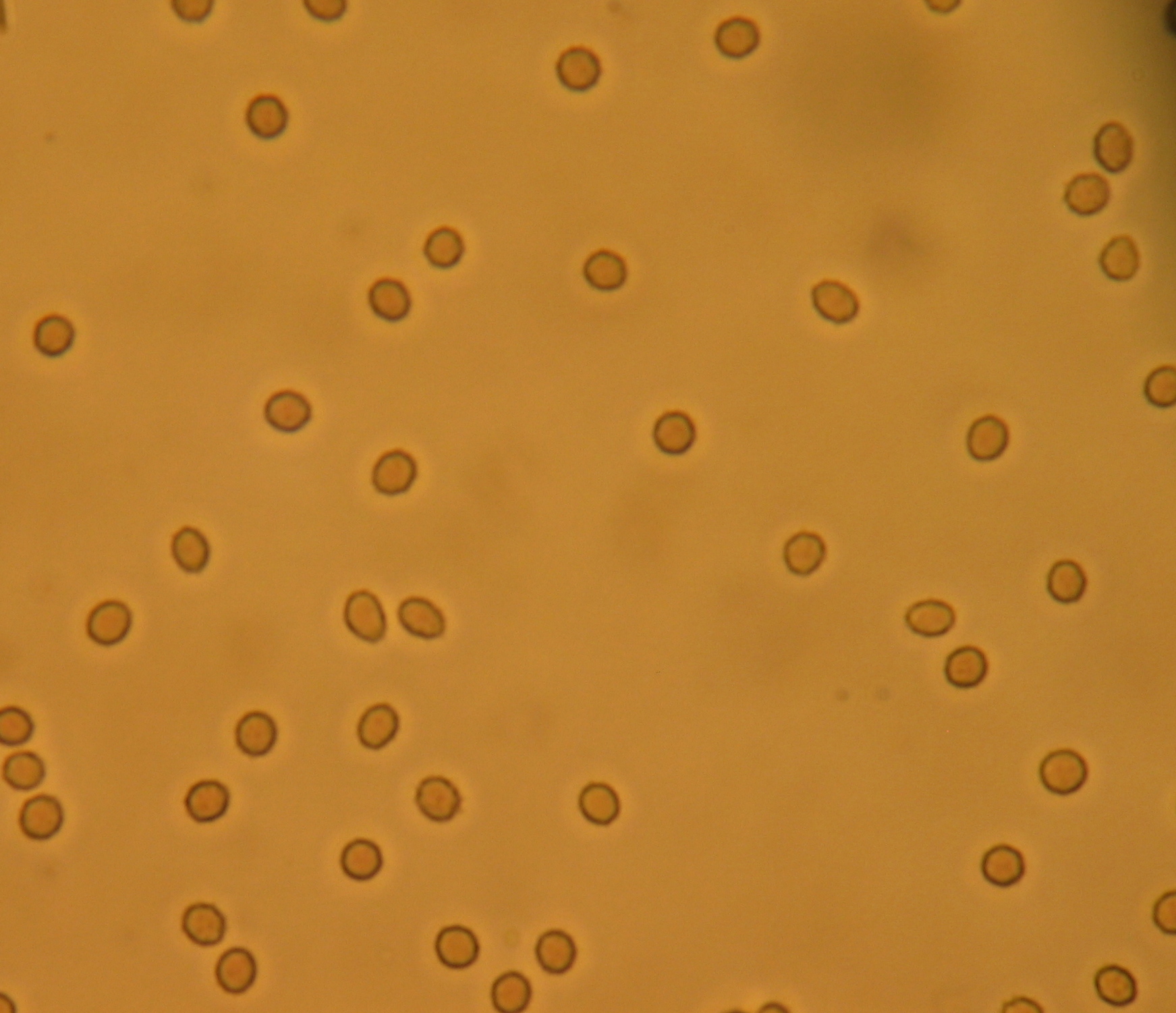 MicroHematuria