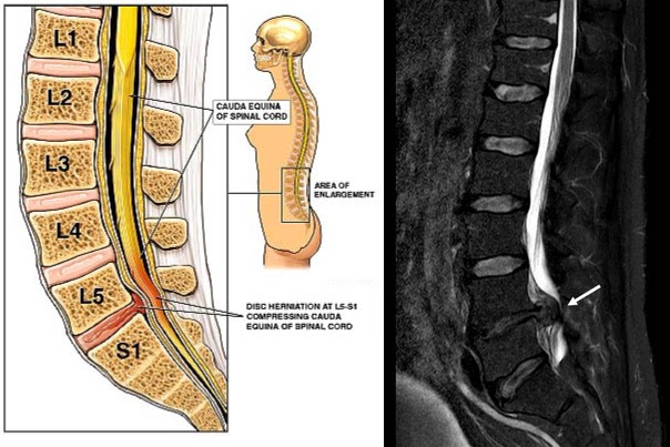 sagittal compared