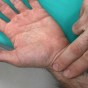 Next Gen Shorts: Is palpable radial pulse a good estimate for systolic blood pressure?